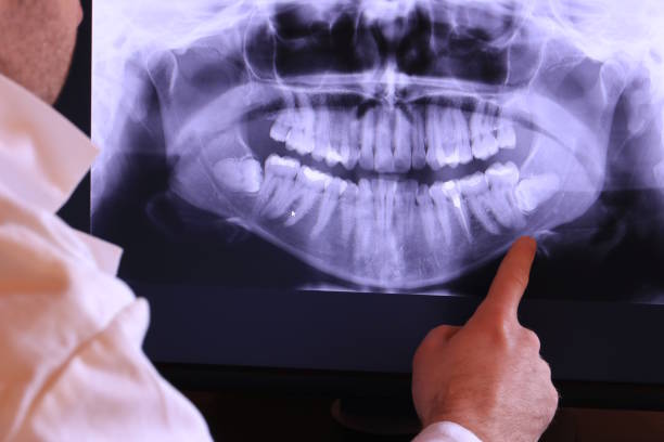 Best Emergency Broken Tooth Repair in Bull Run Mountain Estates, VA