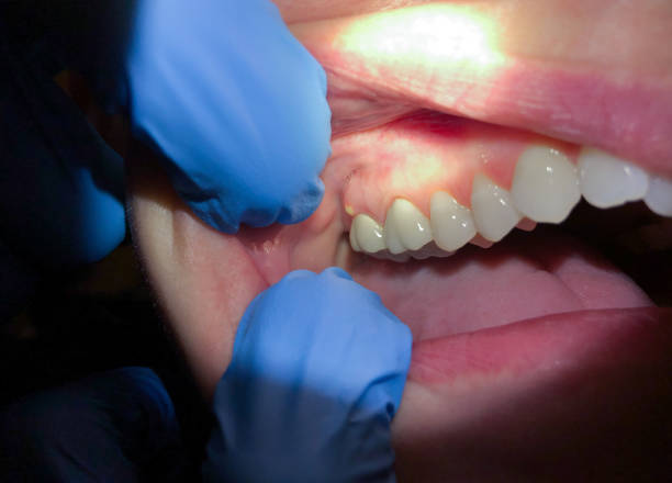Best Emergency Treatment for Toothache in Bull Run Mountain Estates, VA