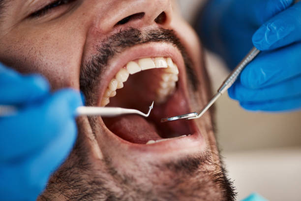Best Same-Day Emergency Dentist in Bull Run Mountain Estates, VA