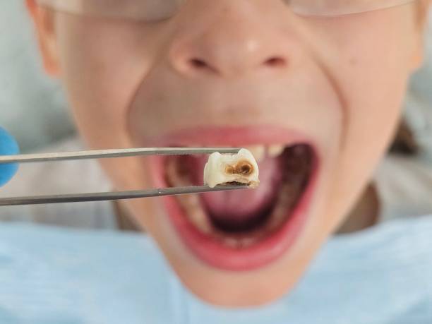 Best Pediatric Emergency Dentist in Bull Run Mountain Estates, VA