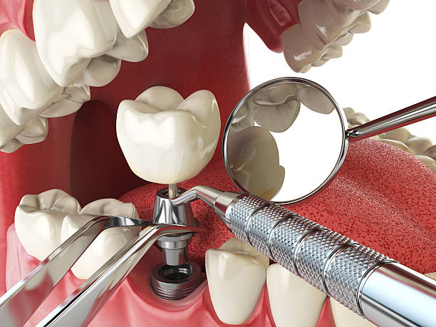 Best Emergency Dental Care for Trauma or Injury in Bull Run Mountain Estates, VA
